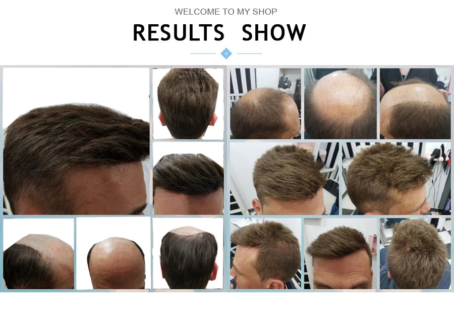 Human Hair Men's Wigs Skin PU Toupee Capillary Prosthesis Unit Replacement System